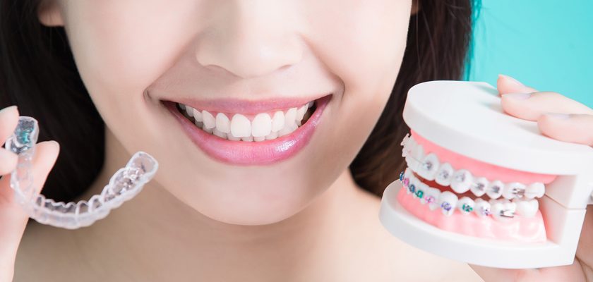 Trattamenti ortodontici