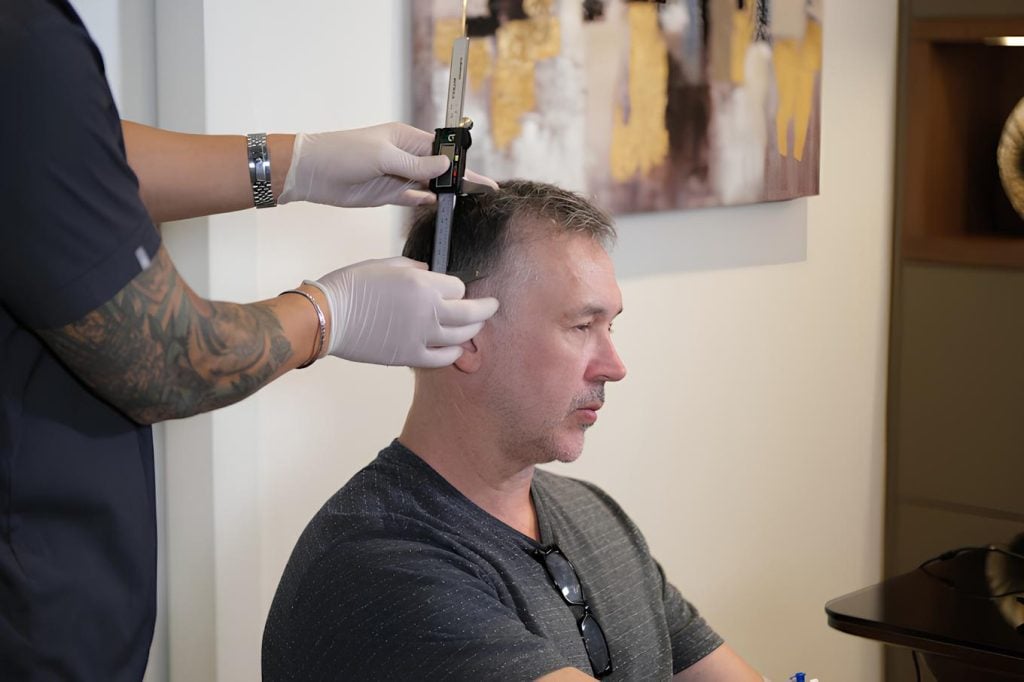 hair-transplant