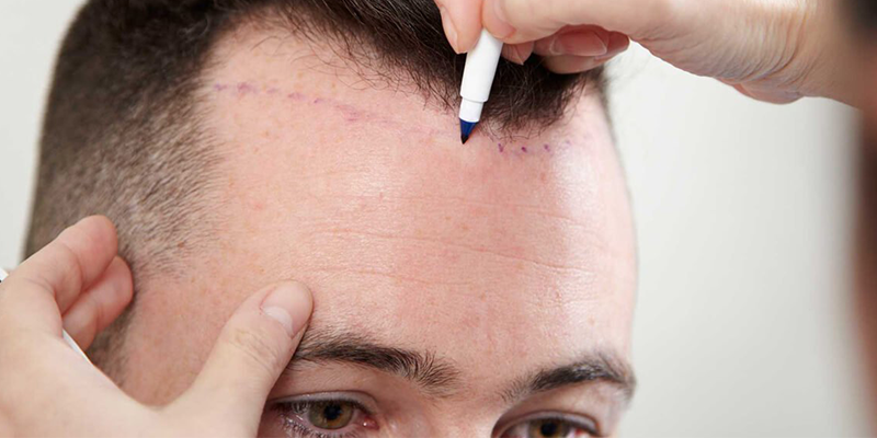 afterhair-800x400-1