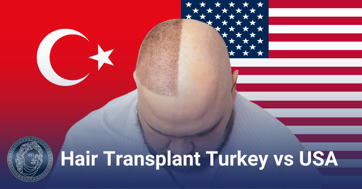 Transplantasi Rambut Turki vs AS: Biaya, Keahlian, Pengalaman Pasien