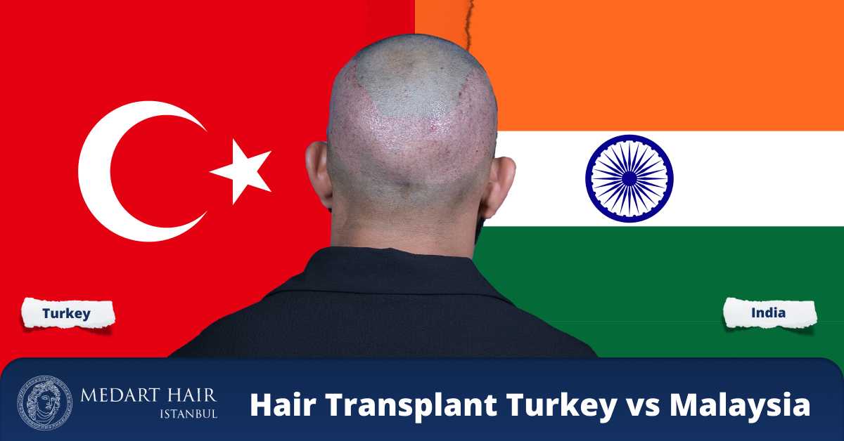hair transplant turkey vs india