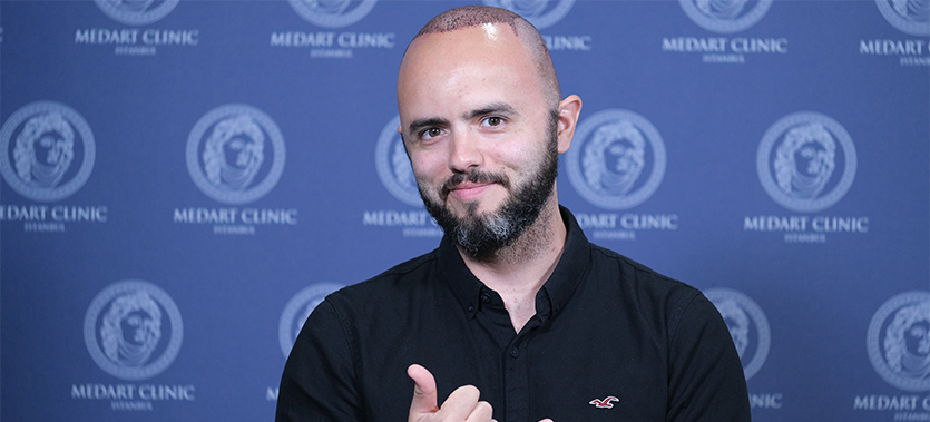 after hair transplantation