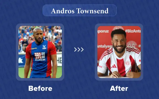 andros townsend hair transplant