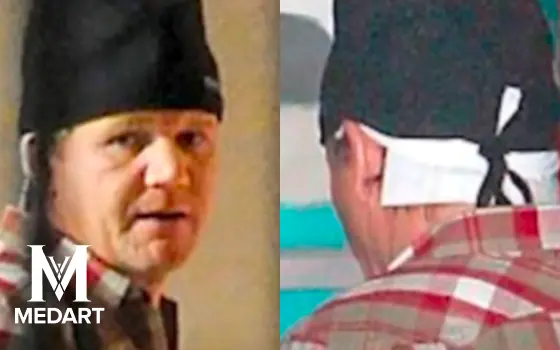 gordon ramsay leaving hair transplant clinic with wound dressings on his scalp