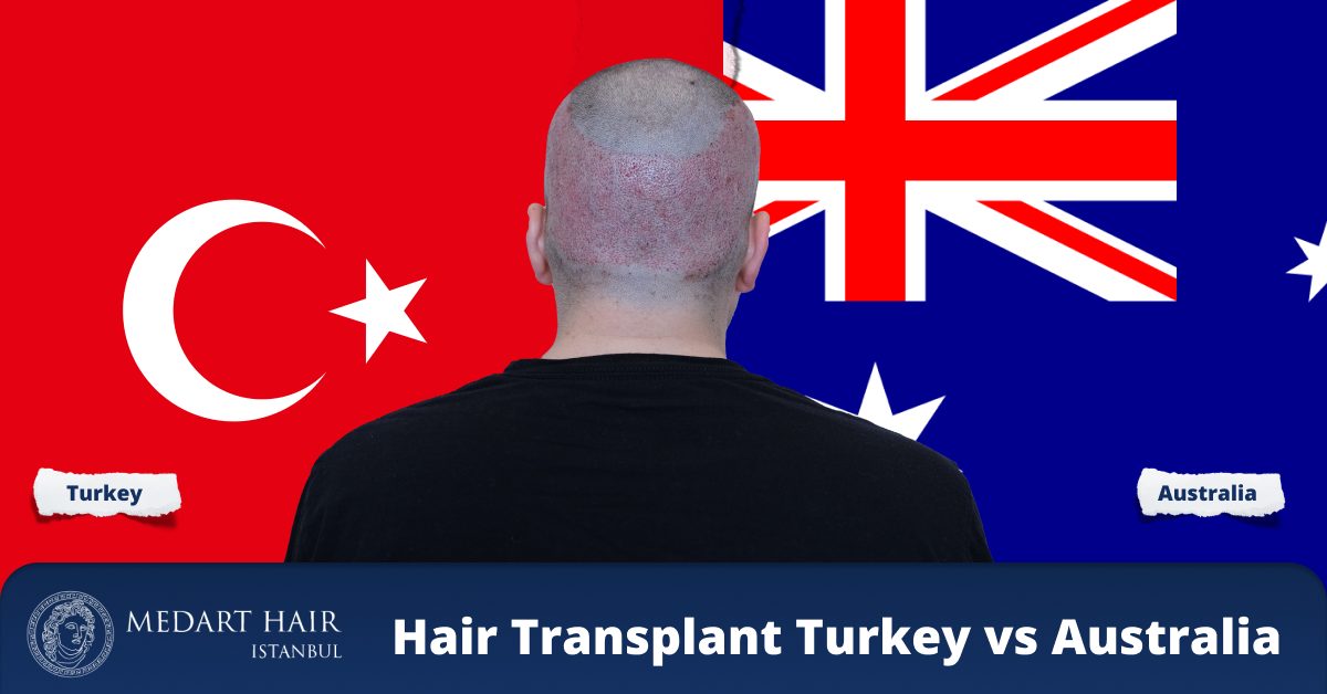 hair transplant australia vs turkey