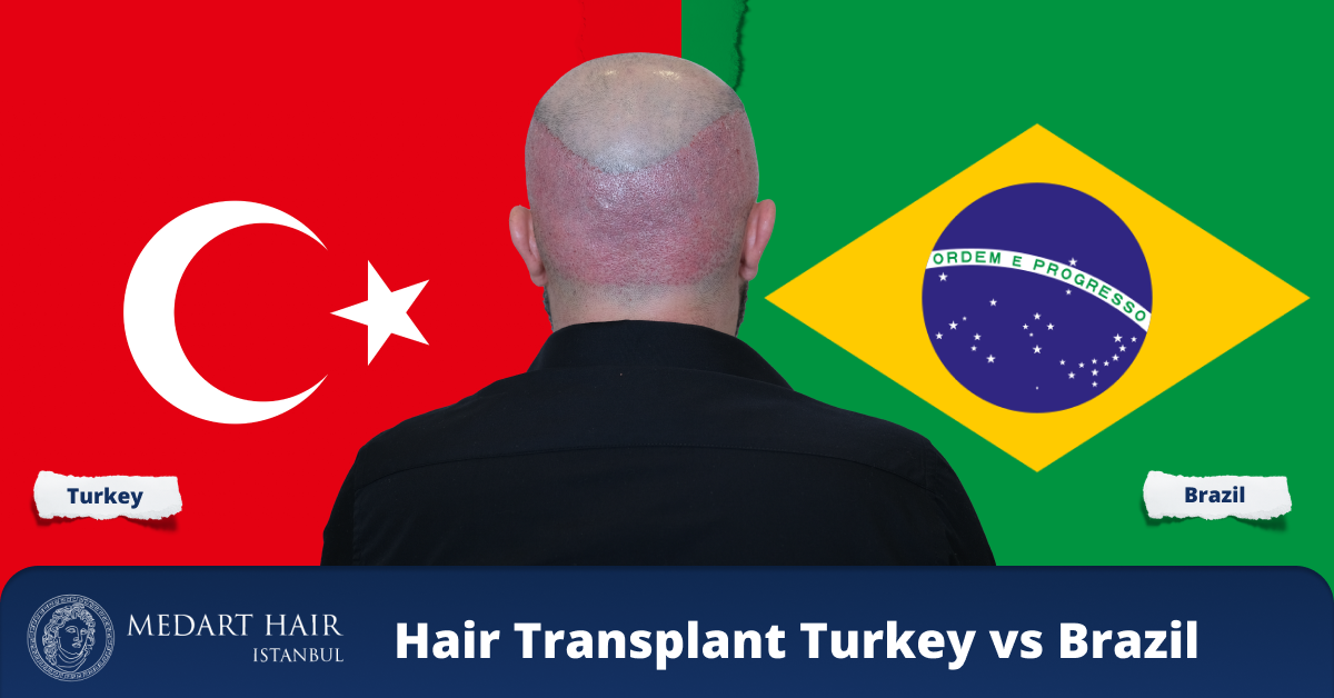 hair transplant brazil vs turkey