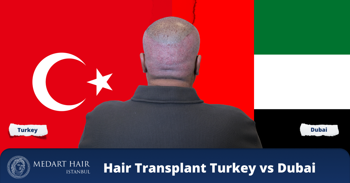 hair transplant dubai vs turkey
