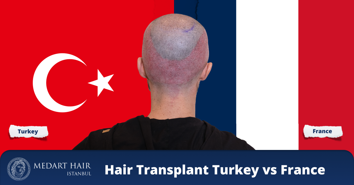 Trapianto di Capelli Francia vs Turchia