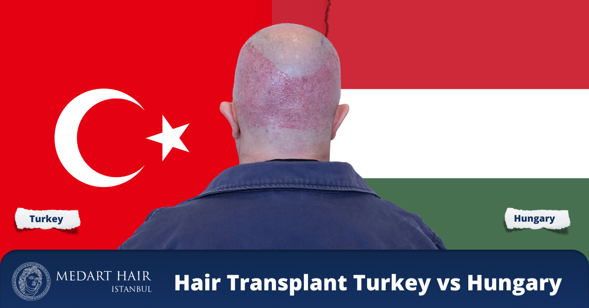 hair transplant hungary vs turkey
