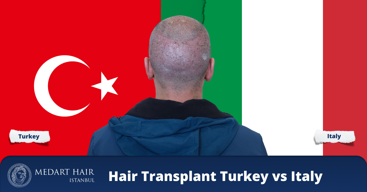 hair transplant italy vs turkey