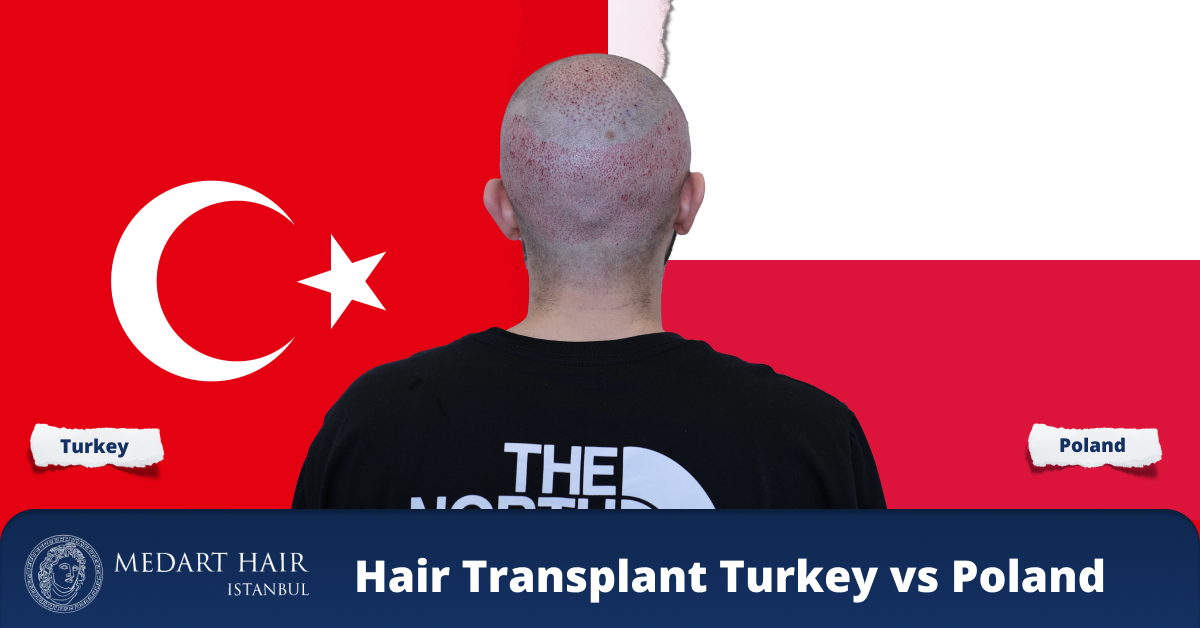 hair transplant poland vs turkey