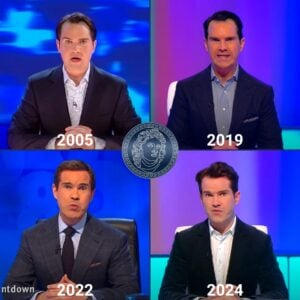 выпадение волос и временная шкала пересадки волос Джеймса Несбита с 2005 по 2004 год