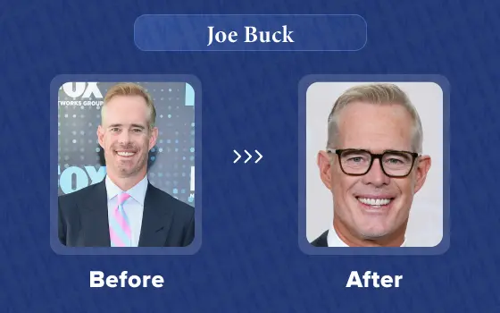 joe buck hair transplant