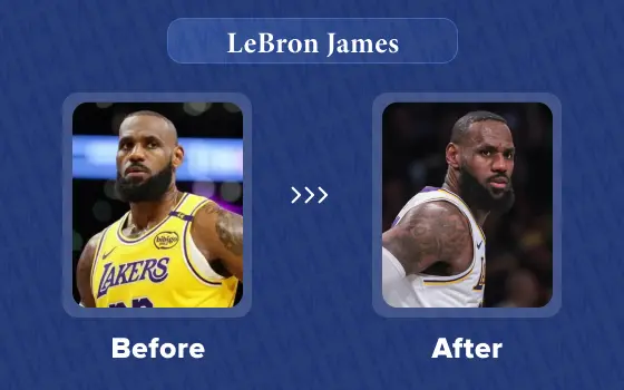 lebron james hair transplant