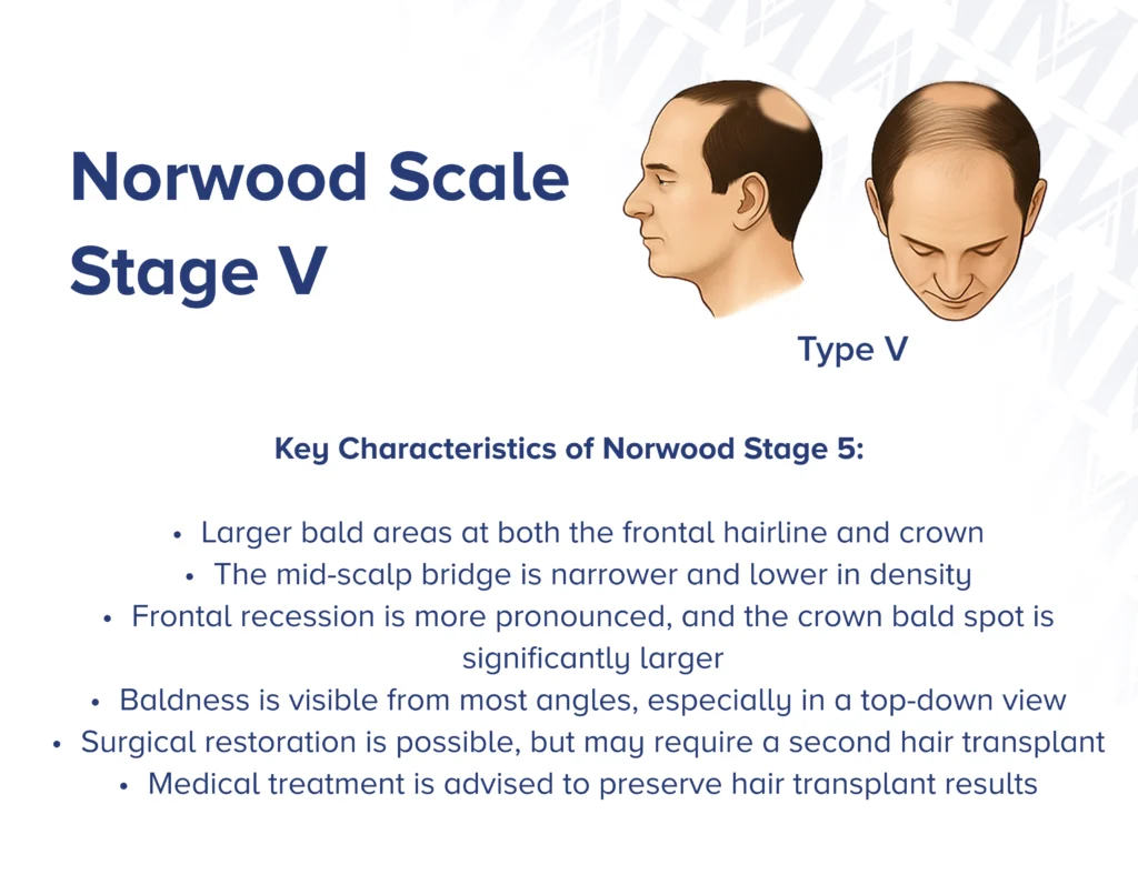 Infographic showcasing  the side profile and front view of Norwood type 5 with key characteristics of the stage