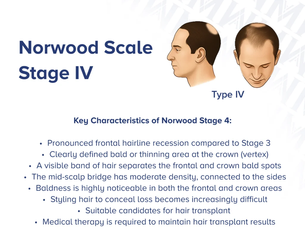 Infographic showcasing  the side profile and front view of Norwood type 4 with key characteristics of the stage