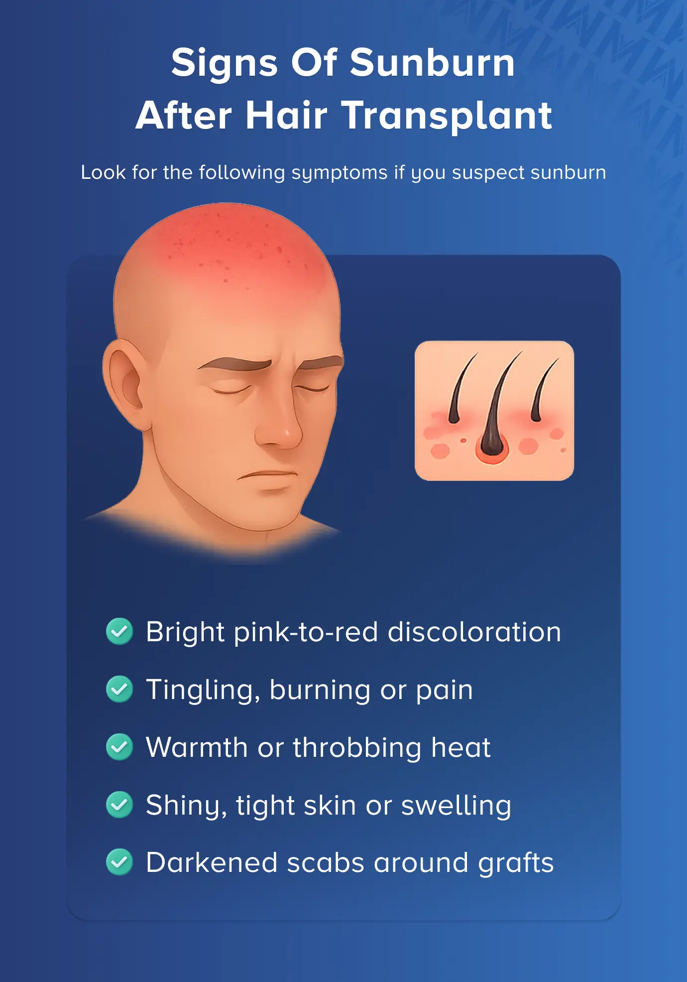 signs of sunburn after hair transplant
