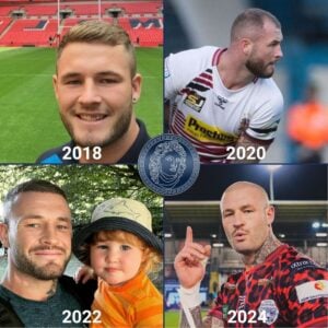 zak hardaker saç kaybı ve saç ekimi zaman çizelgesi 2018'den 2024'e