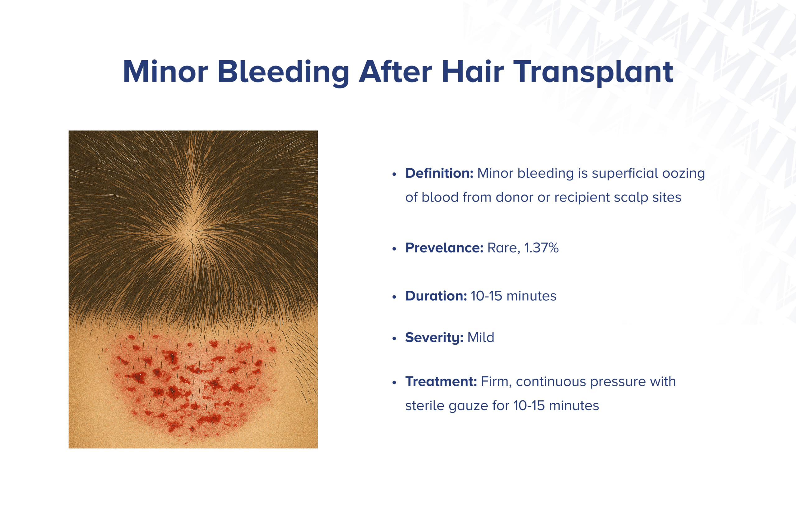 Geringfügige Blutung nach Haartransplantation