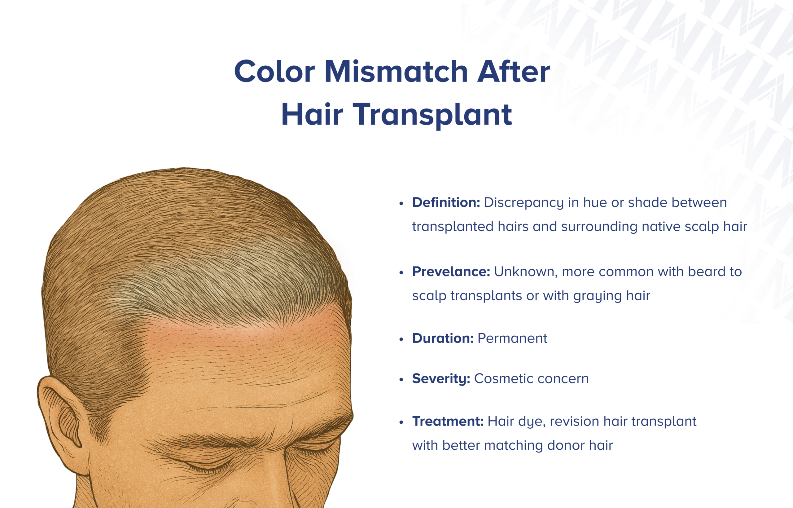 Farbfehlanpassung nach Haartransplantation