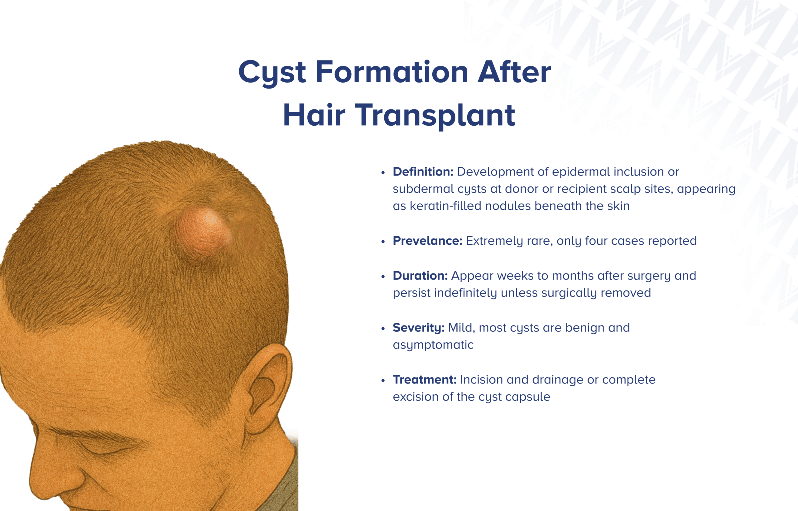 Zystenbildung nach Haartransplantation
