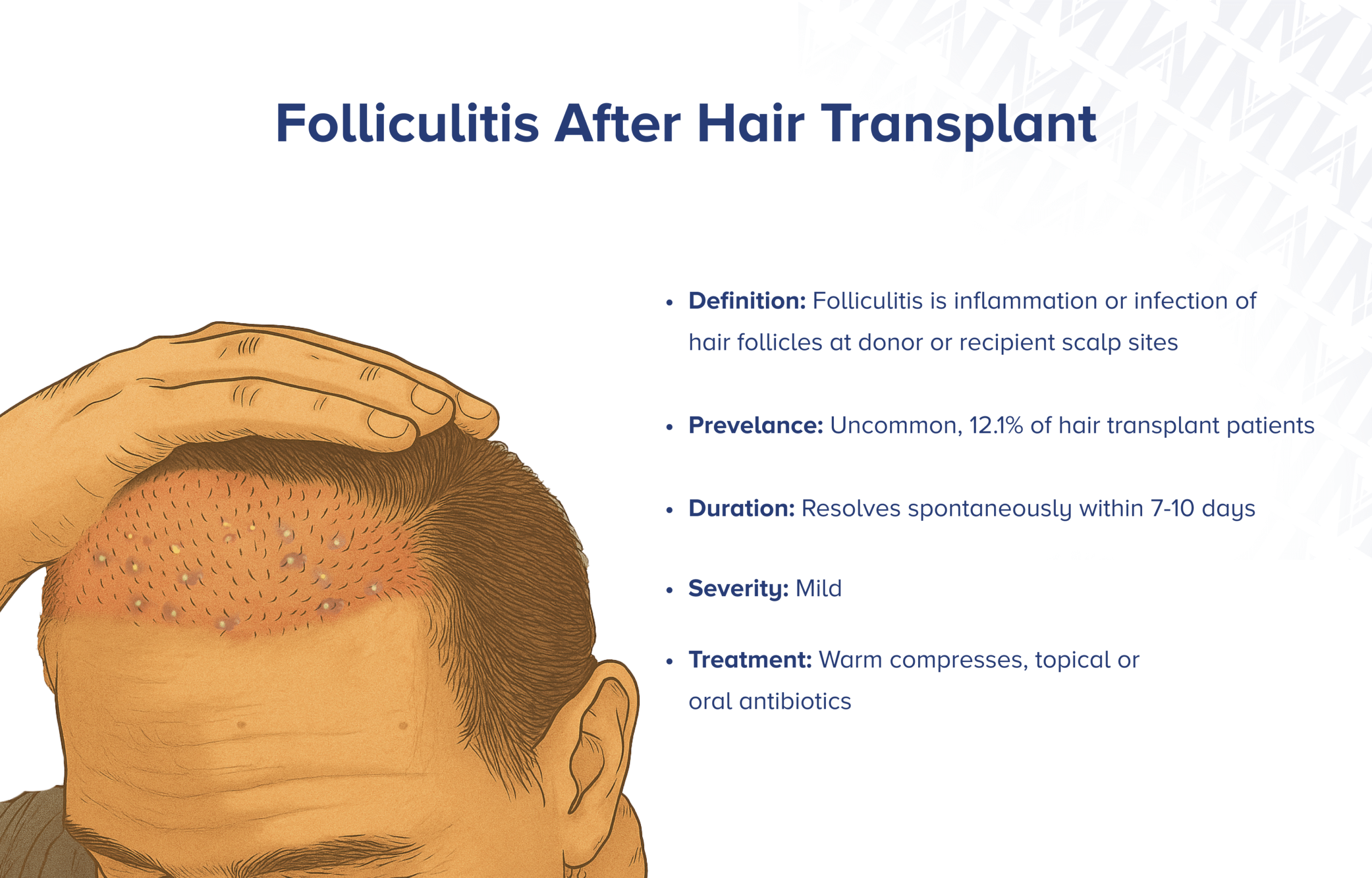 Follikulitis nach Haartransplantation