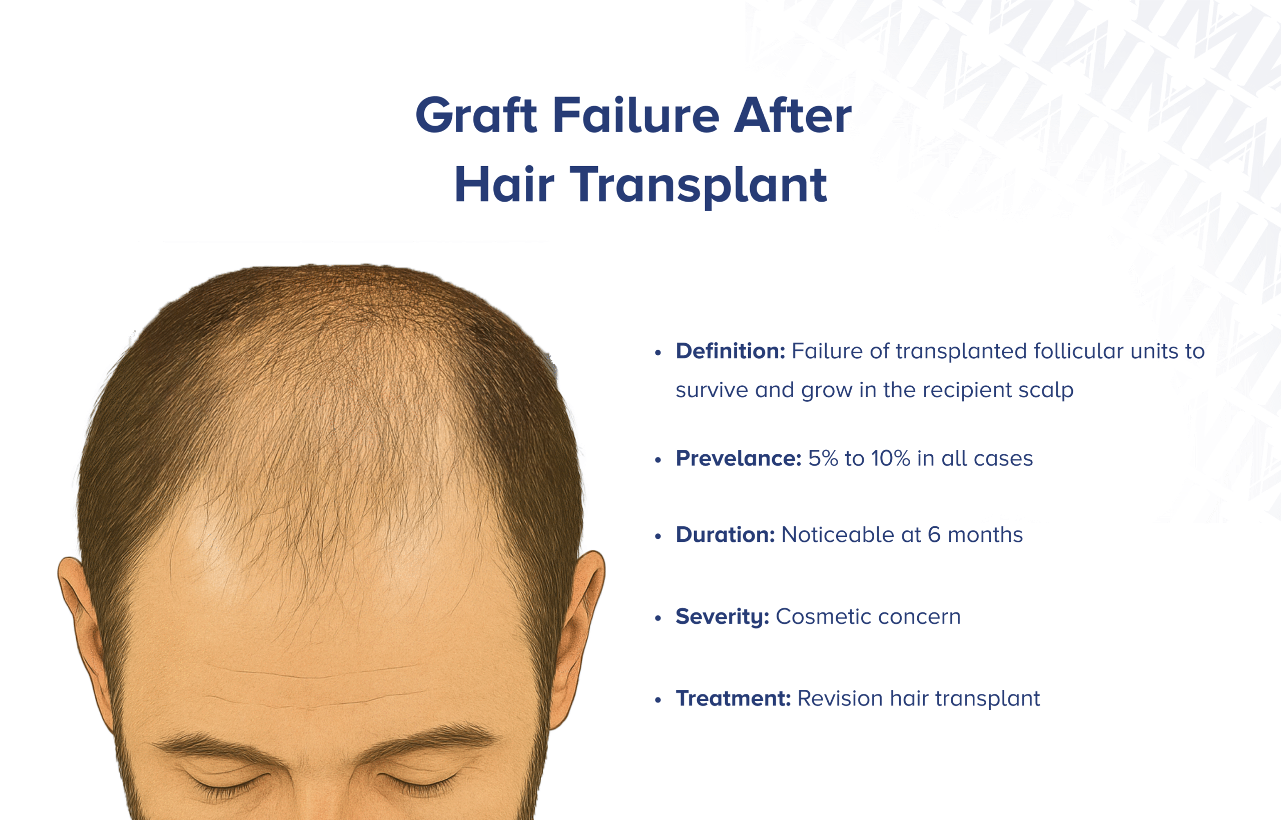 Transplantatversagen nach Haartransplantation