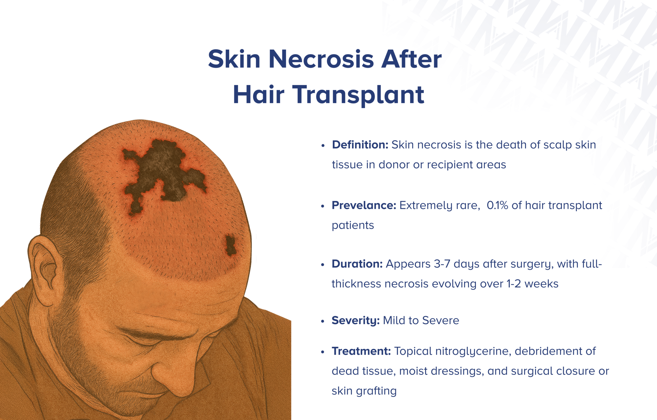 Hautnekrose nach Haartransplantation