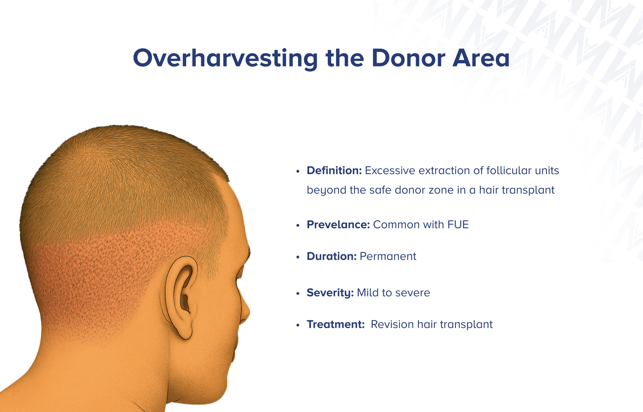 Überentnahme nach Haartransplantation