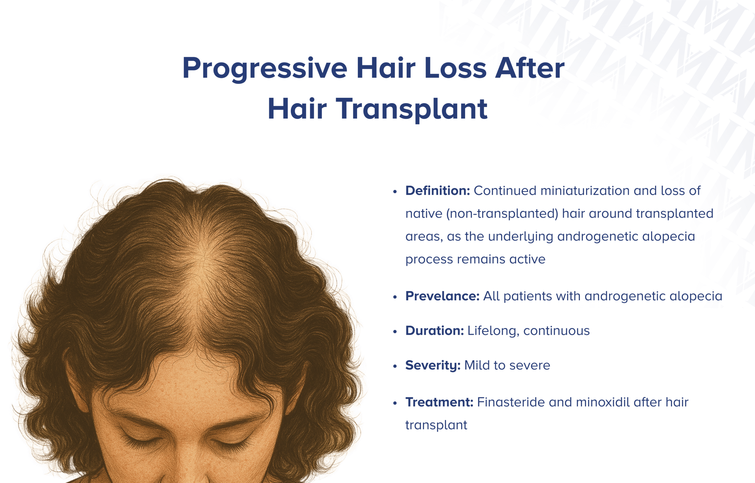 Progressiver Haarverlust nach Haartransplantation