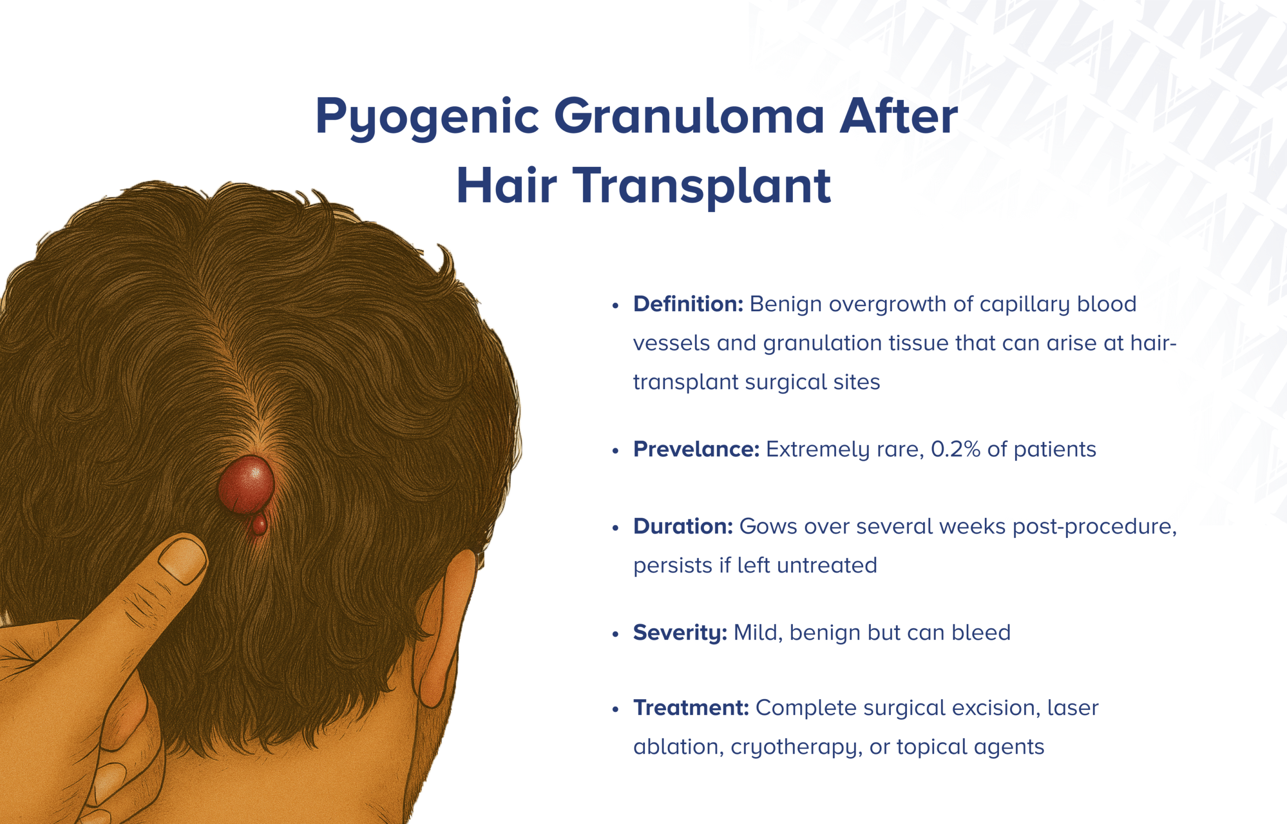Pyogenes Granulom nach Haartransplantation