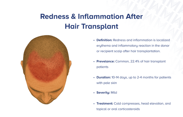 Reduce Redness After Hair Transplant: Coping With a Common Side Effect