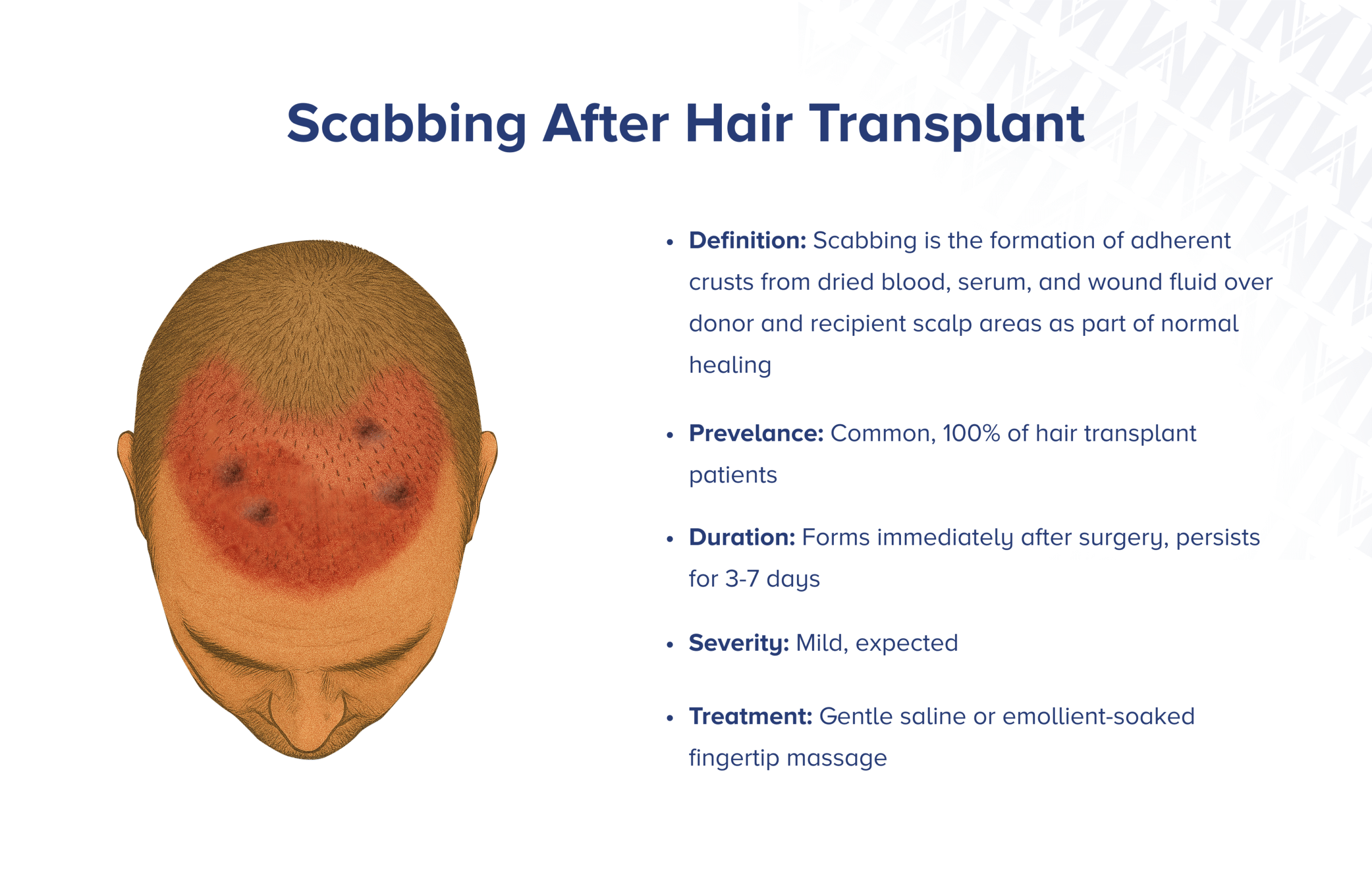 Krustenbildung nach Haartransplantation