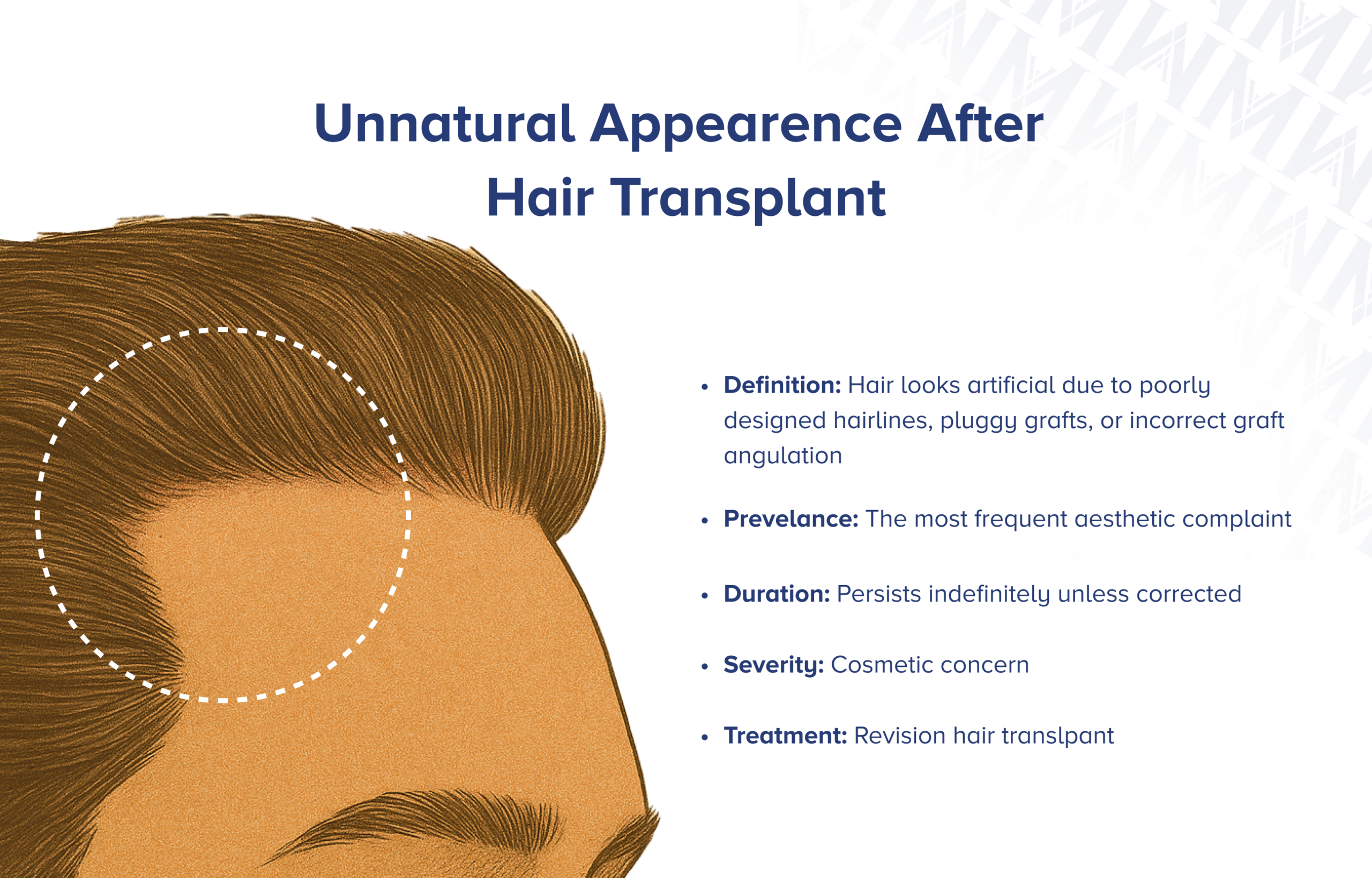 Unnatürliches Aussehen nach Haartransplantation