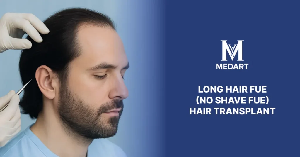 Long Fue Hair Transplant