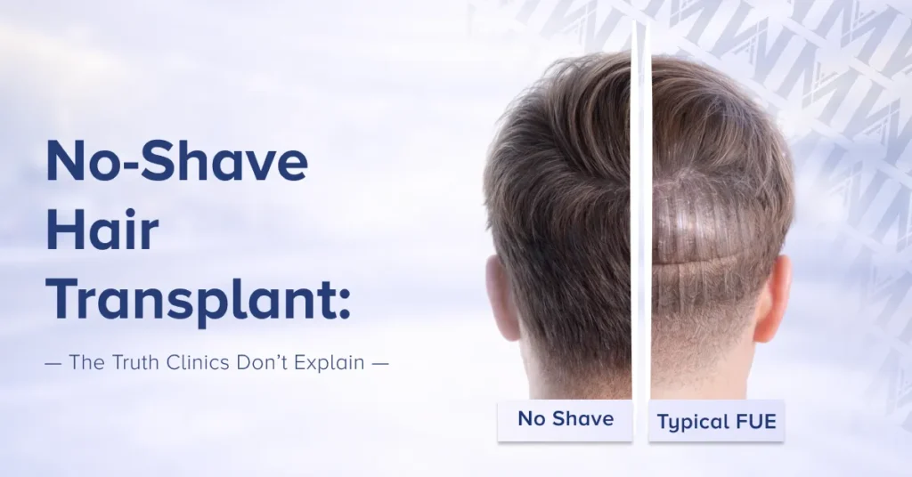No shave hair transplant
