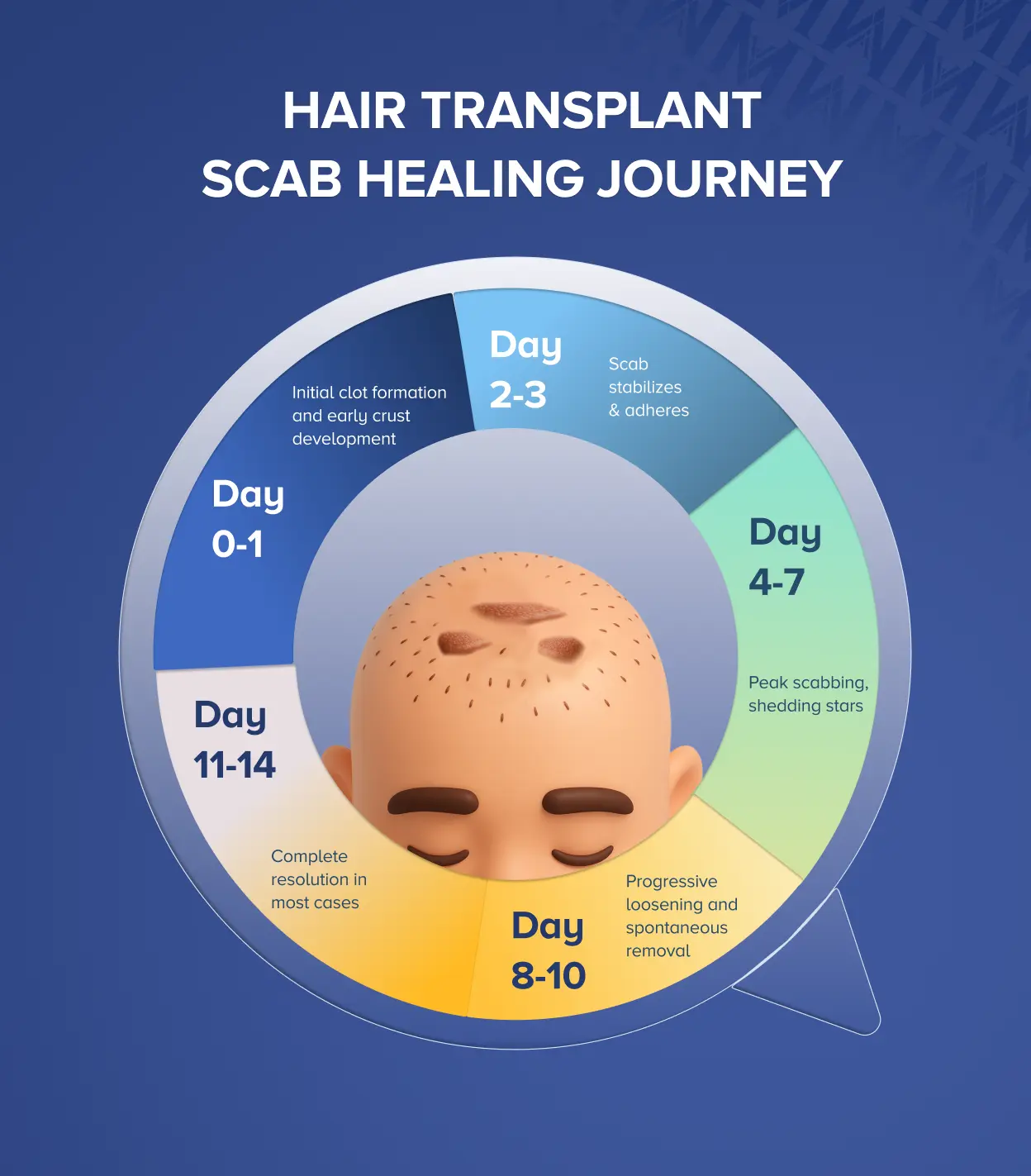 Hair Transplant Scabs: When to Remove or Seek Help 

