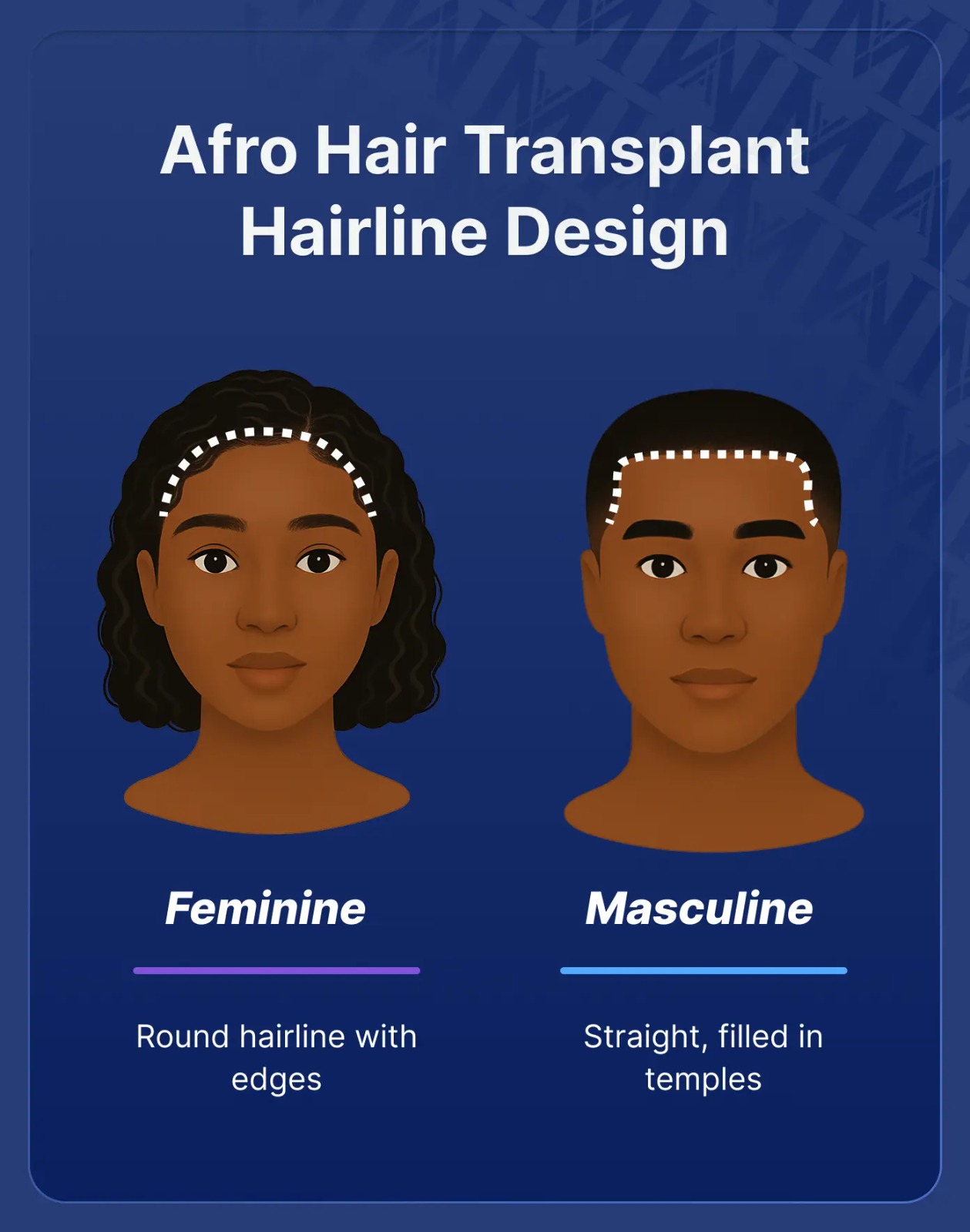 afro-hair-transplant-hairline-design
