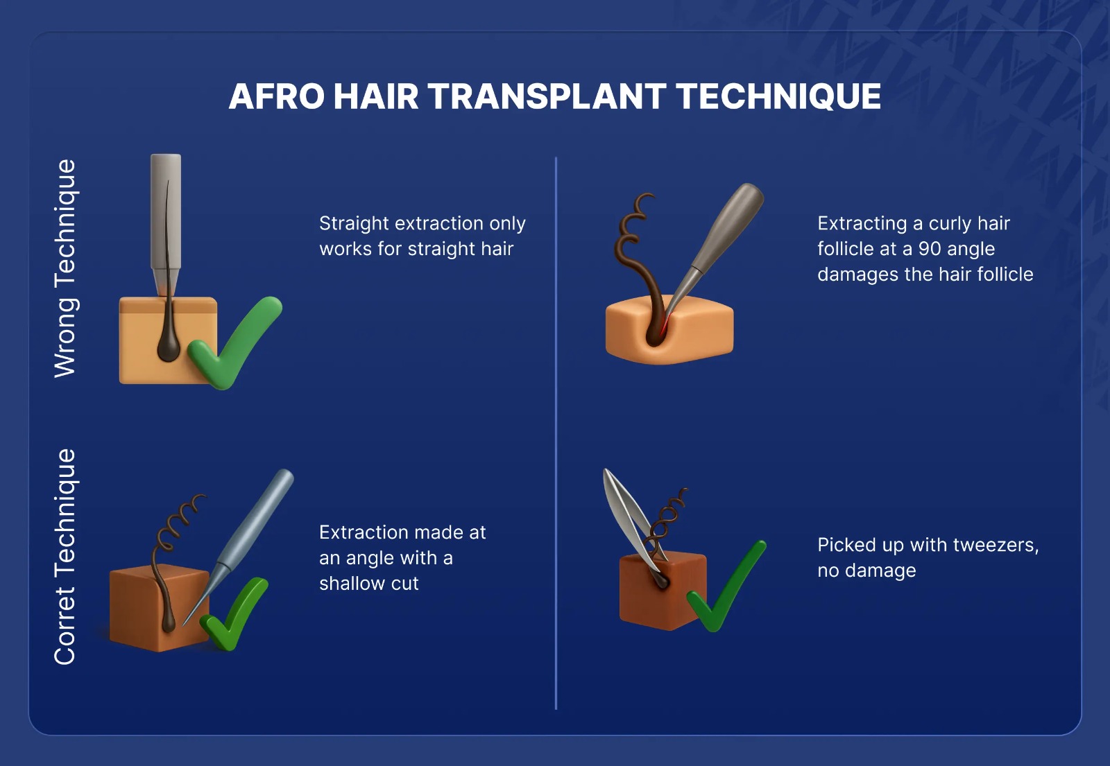 afro hair transplant technique