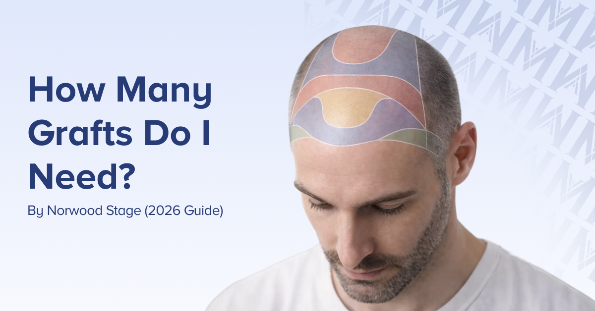 How-Many-Grafts-Do-I-Need_