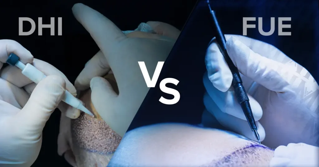 Dhi vs. fue which treatment right for you?
