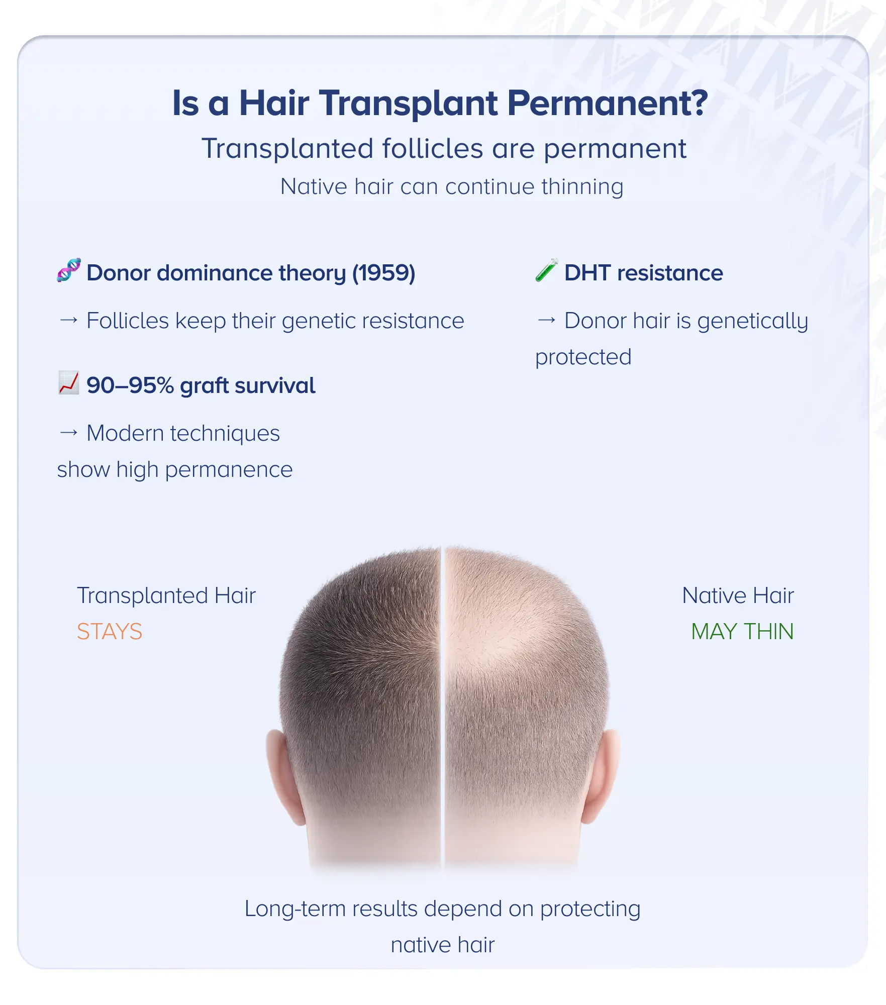 Is a Hair Transplant Permanent
