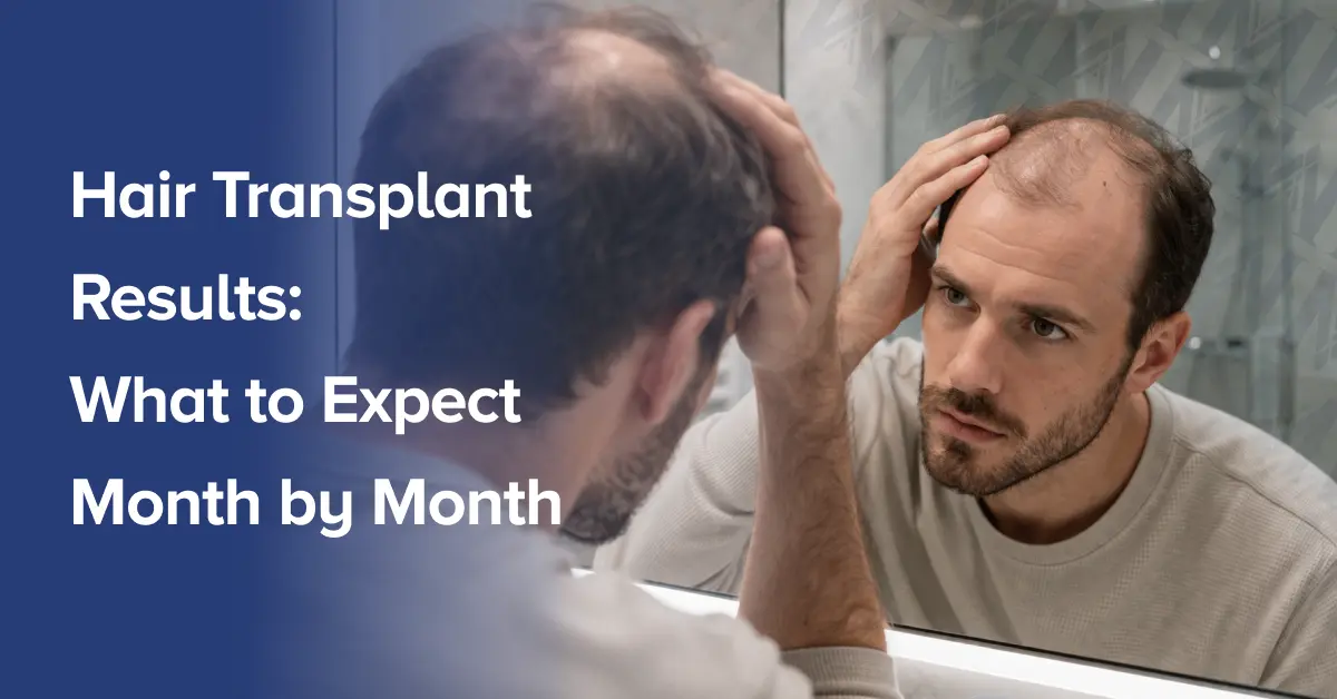 Hair Transplant Results What to Expect Month by Month