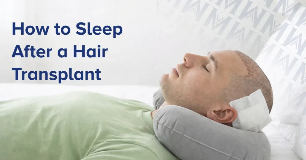 How to Sleep After a Hair Transplant
