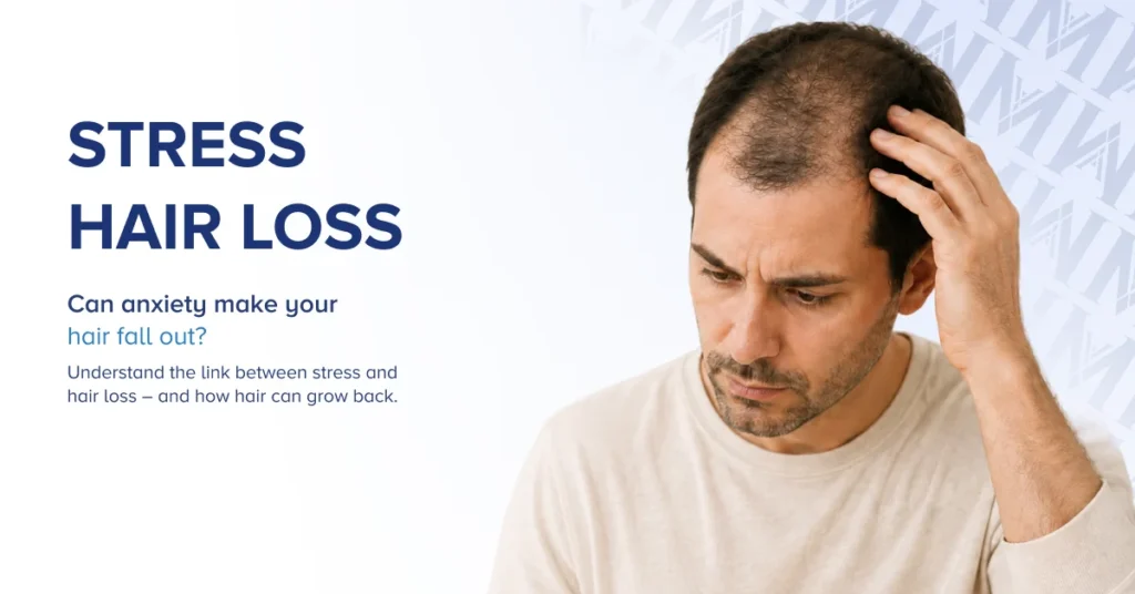 Stress Hair Loss: Can Anxiety Make Your Hair Fall Out?