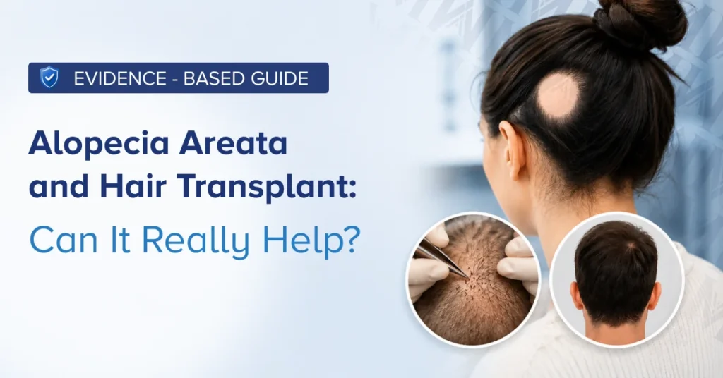 Alopecia Areata and Hair Transplant: Can It Really Help?
